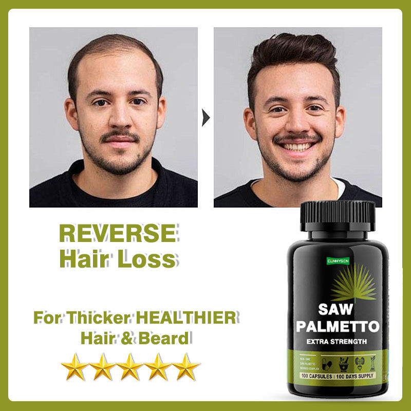 Fabricante de Suplemento Saw Palmetto cápsulas Extra Força Para Reduz a Perda de Cabelo Apoia o Crescimento